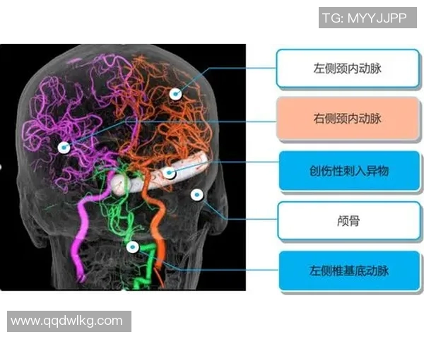 深圳网球队防反体系解析:提升网球战术的关键要素与实战应用 深圳网球队防反体系解析:提升网球战术的关键要素与实战应用